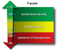 T-score normative data for bone mineral density 